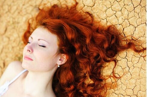 A girl with psoriasis